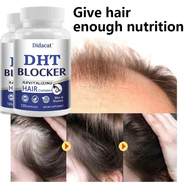 Saw Palmetto Prostate Supplement Reduces Prostate Inflammation DHT Blockers Promote Hair Growth, Hair Loss, Thinning Hair in Men - Image 4